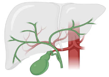 Gallstones: causes, symptoms and treatment